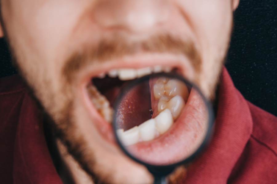 Oral cancer symptoms you should not ignore and when to seek care