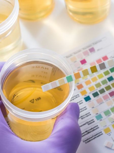 Why does the colour of urine turn yellow in summer dgtl