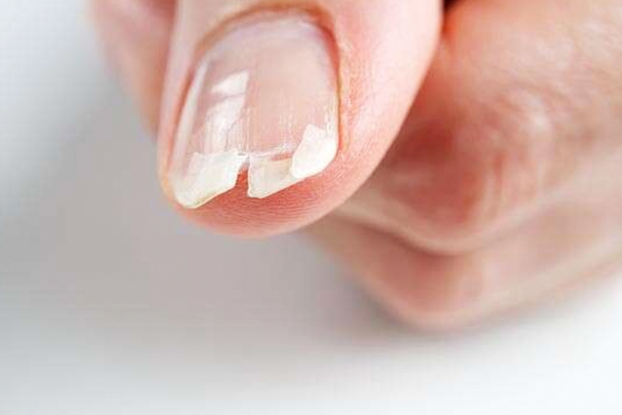 Home remedies for Cracked Nails