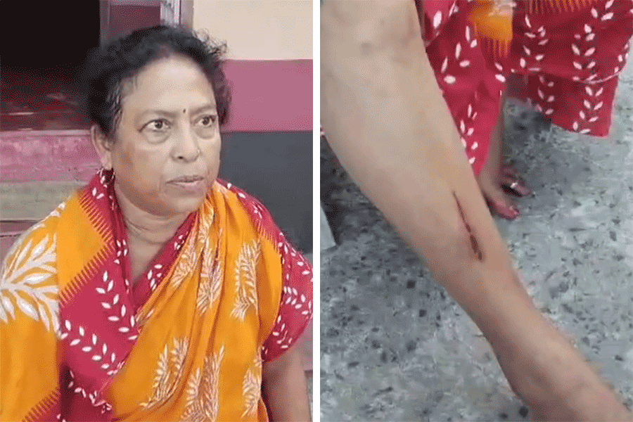 Attack on Minakhan TMC MLA Usha Rani Mondal on Kali Puja night in Haroa dgtld