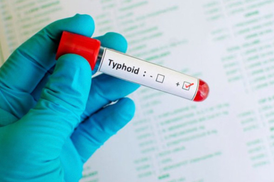 Typhoid Mary was a cook who was believed to have infected hundreds of America with typhoid fever