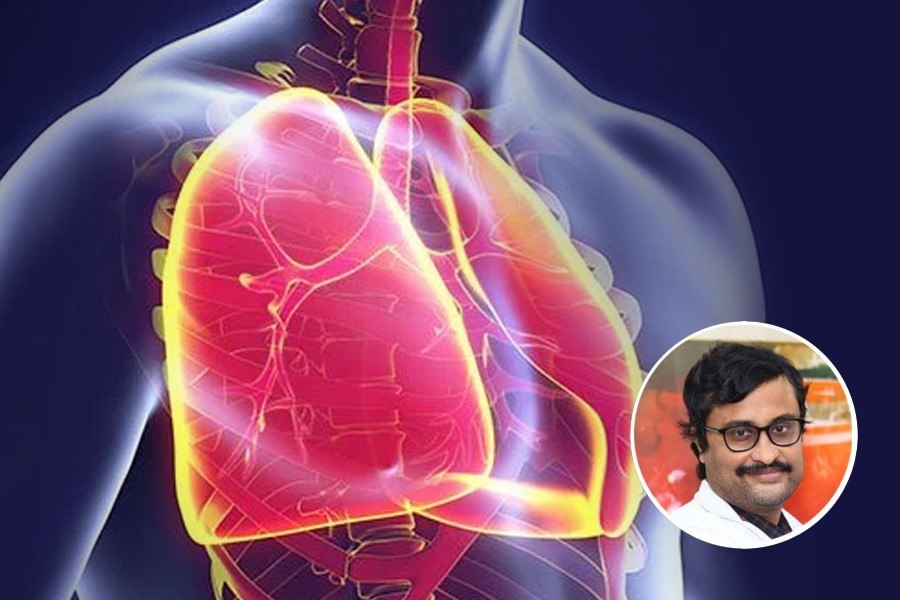 Manipal Hospitals has one of the biggest pulmonary departments in West Bengal, explains Dr. Debraj Jash dgtl