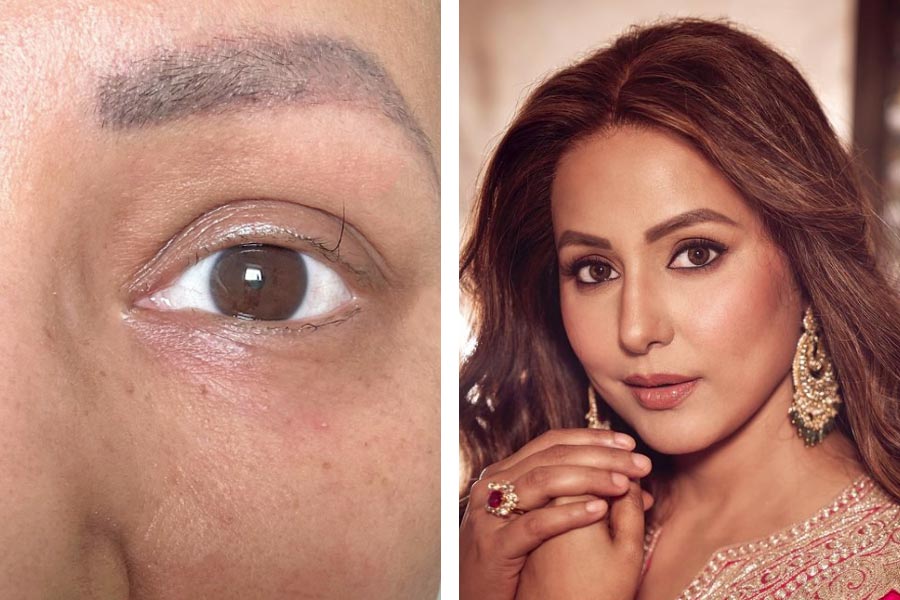 Hina Khan shares a heartfelt post from her cancer journey