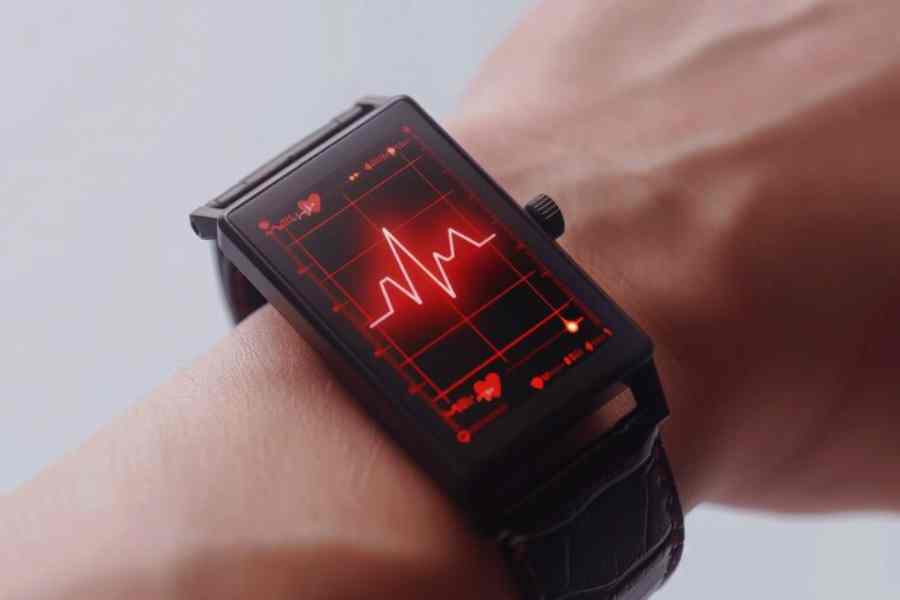 Smartwatches can detect early signs of heart conditions, study finds