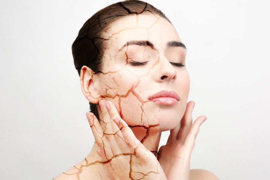 শীতের সময়ে রুক্ষতা বাড়ে বহু গুণ। ত্বক ফাটার সমস্যা তো চিরন্তন। এর পাশাপাশি ত্বক ফেটে, স্কিন ফ্লেকিং, এগজিমার মতো সমস্যাও দেখা যায়। কিন্তু শীত পড়ার আগেই যদি ত্বকের খেয়াল রাখা যায়, তা হলে ত্বক ফাটা এবং সেই জাতীয় নানা শীতকালীন সমস্যা থেকে অনেকটাই রেহাই পাওয়া যাবে। ত্বক ফাটার সম্ভাবনা তৈরি হলে, ত্বকে টান ধরার উপক্রম হলে আগে থাকতেই ময়শ্চারাইজার ব্যবহার করা জরুরি। 