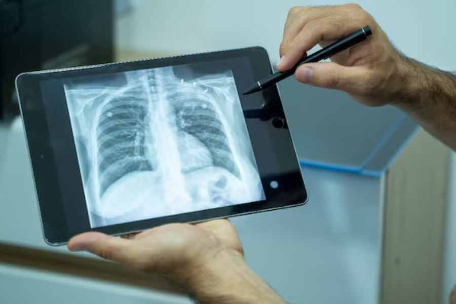 An indigenous X-ray device has been developed by IIT Kanpur scientists