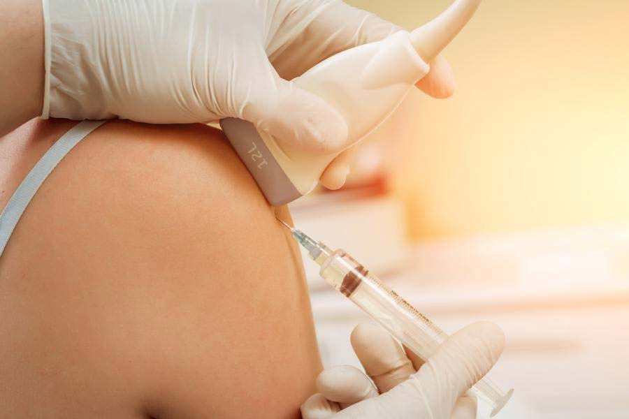 Johnson Bryan underwent a total plasma exchange to his age-reversing regimen