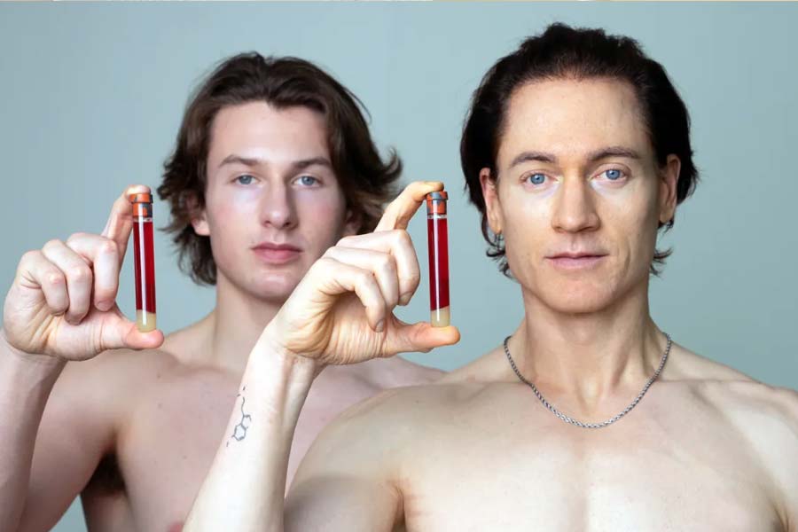 Johnson Bryan underwent a total plasma exchange to his age-reversing regimen