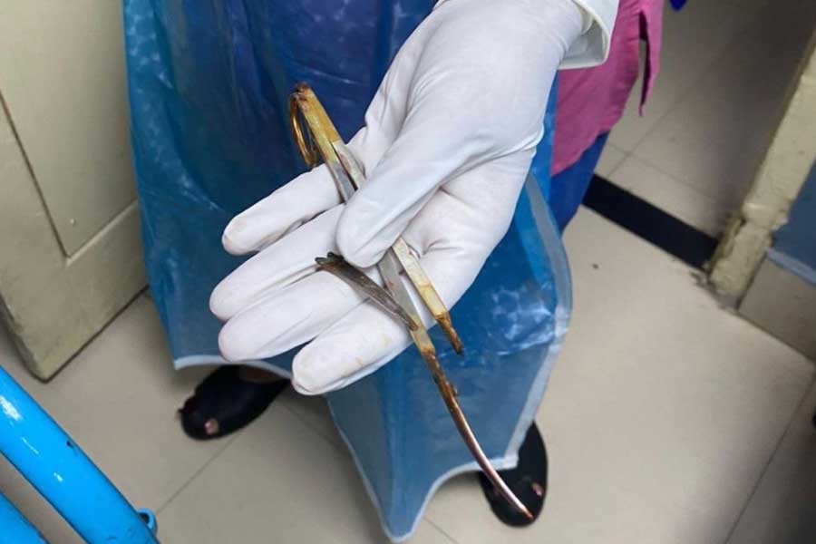 Scissor allegedly broken apart while doctor operating through it in SSKM dgtl