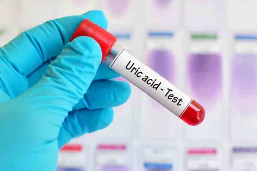 ইউরিক অ্যাসিডের মাত্রা কমানোর উপায়।