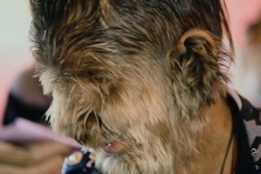 A teenage boy with a rare medical condition called Werewolf Syndrome 