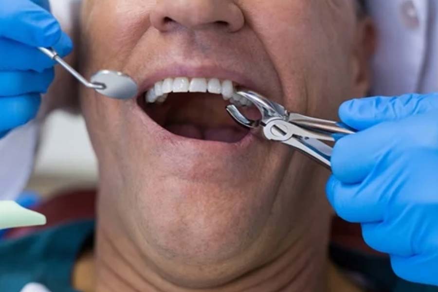 Man dies after 23 teeth extracted and 12 implants placed in one day