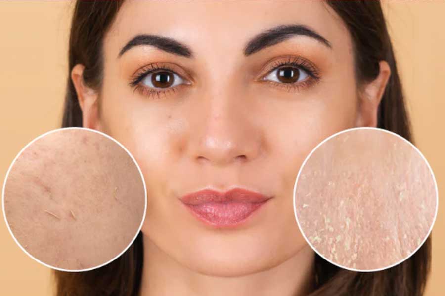 What does skin pilling mean and how to avoid it