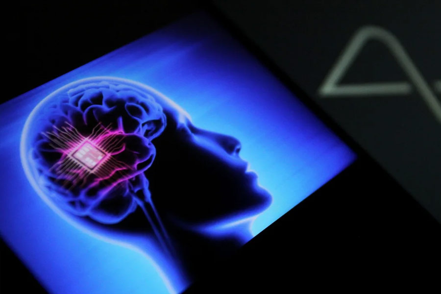 Man can now control Amazon Alexa with his thoughts by using Brain Implant