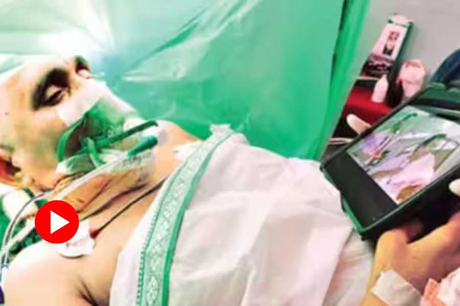 Video of man watching movie while brain surgery in Andhra Pradesh