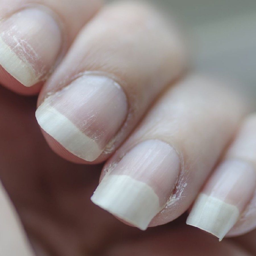 Summer Nail Care tips for healthy nails from tip to toe