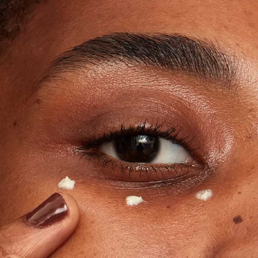 Is under eye cream really necessary, explained by dermatologist