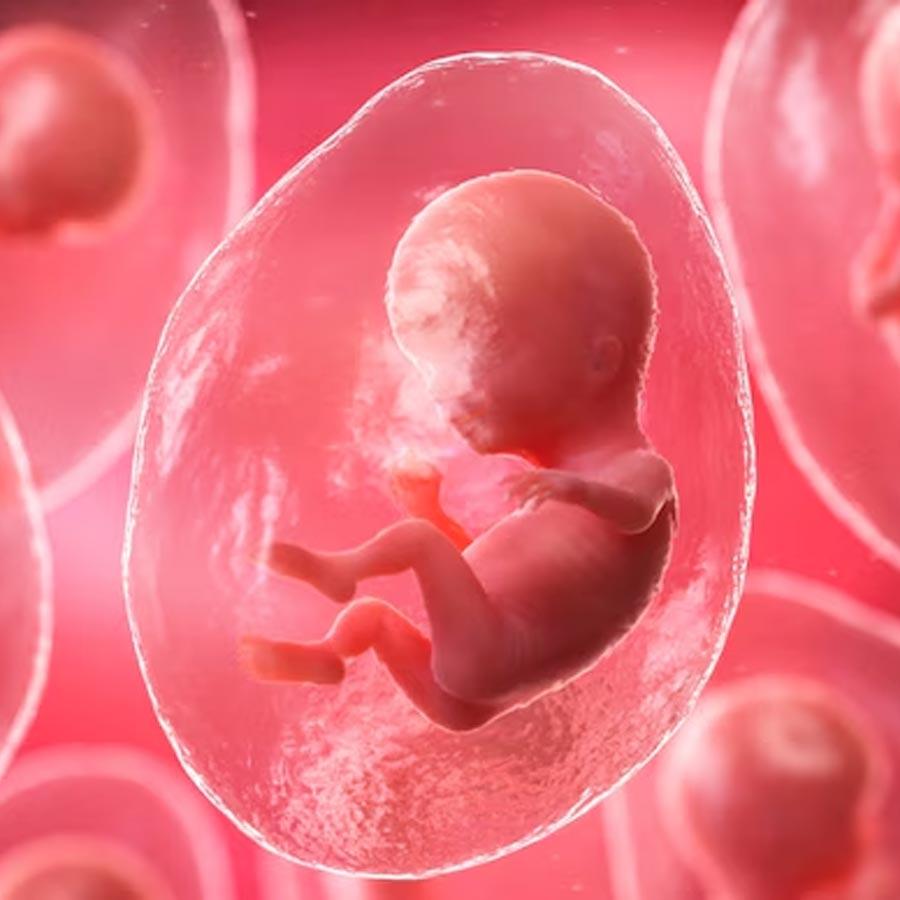 The world\\\\\\\\\\\\\\\\\\\\\\\\\\\\\\\'s first baby has been born using an AI-assisted IVF system
