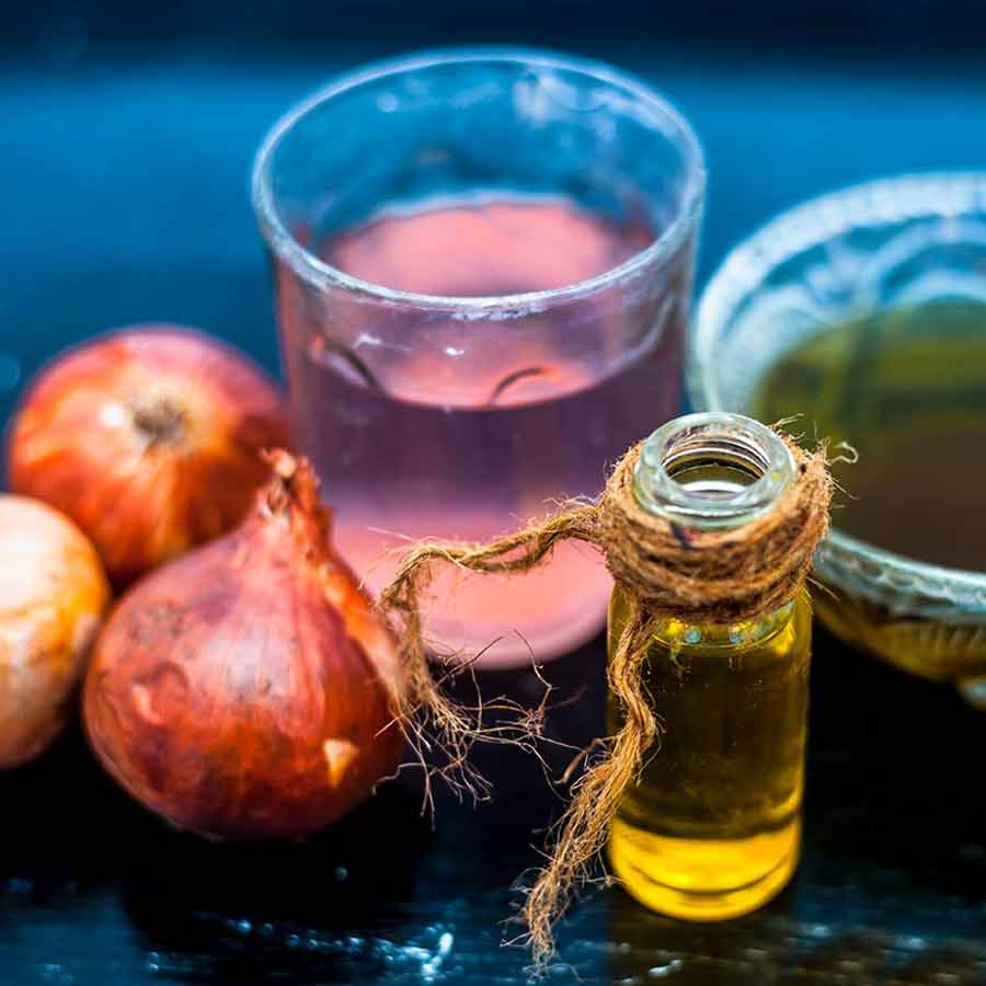 Hair care tips Onion Juice or Onion Oil which is better for hair growth