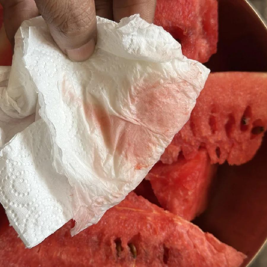 How to check for adulteration in watermelons amid row over chemicals being injected into the fruits