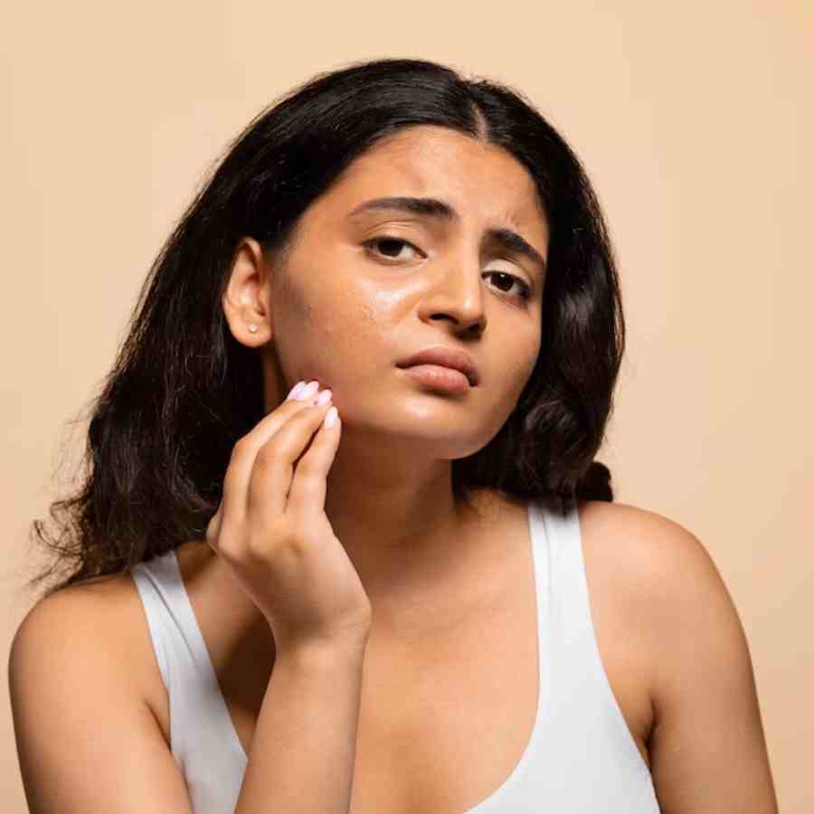 মুখের কালো দাগছোপ উঠবে কী ভাবে?