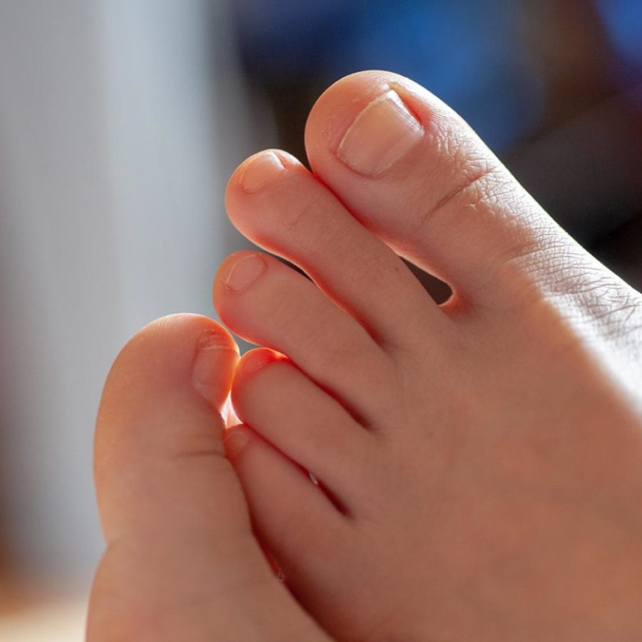 Maharashtra’s buldhana’s residents complains about losing toe nails 3 months after reporting hair loss dgtl