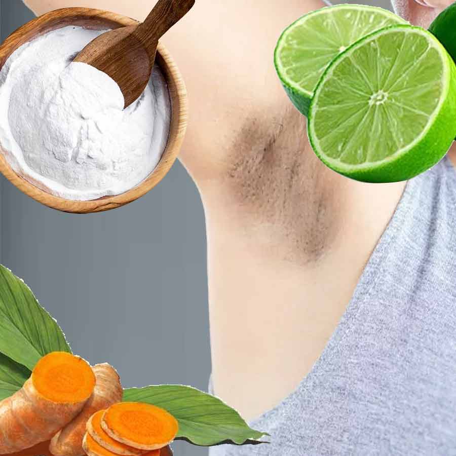 বাহুমূলের কালচে দাগ তোলার ঘরোয়া টোটকা কতটা নিরাপদ?