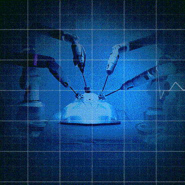 What is Robotic assisted surgery, know the benefits and operating costs in Kolkata