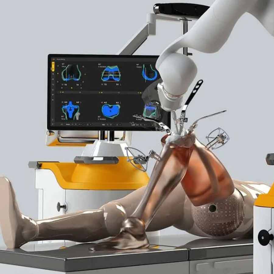 World’s first fully autonomous robotic joint replacement surgery sets a new global benchmark
