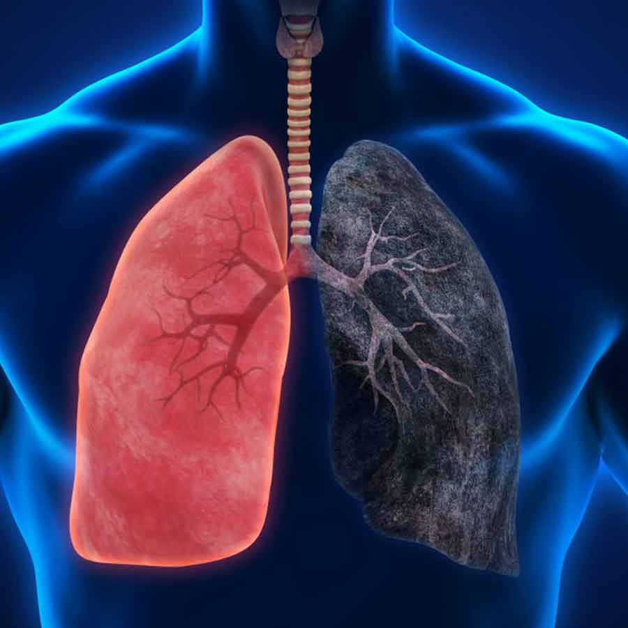 5 everyday habits that damage your lungs without smoking