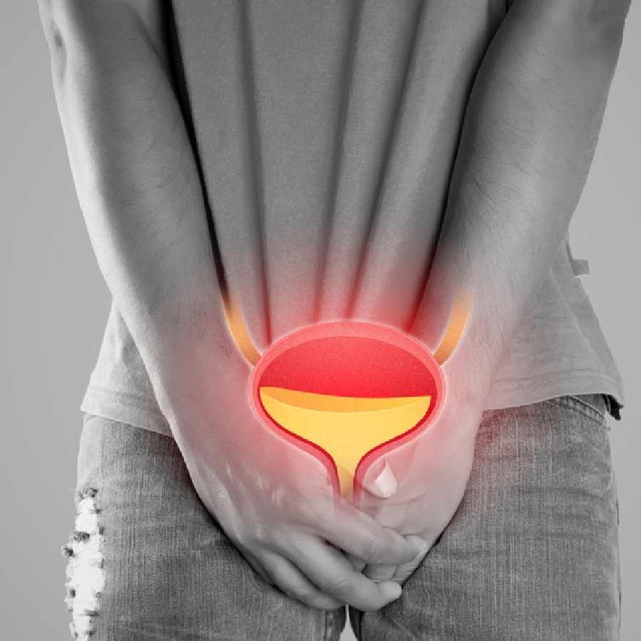Factors that leading Urinary Tract Infection among men dgtl