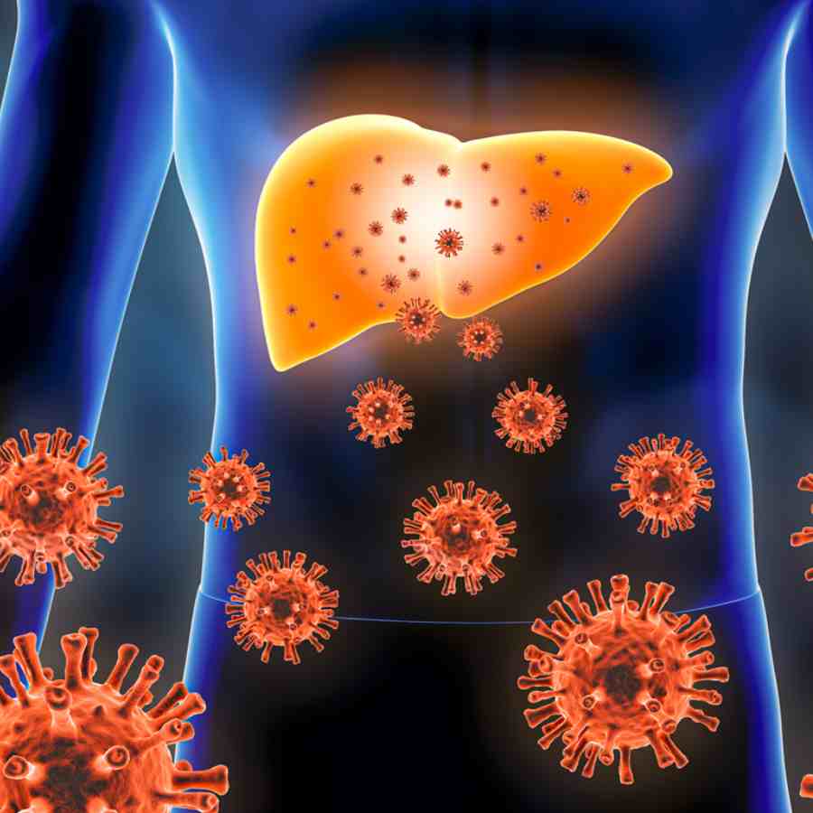 WHO has recently classified hepatitis D as carcinogenic that can cause Liver Cancer