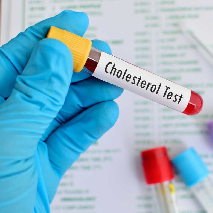 At what age should you first get your cholesterol checked dgtl