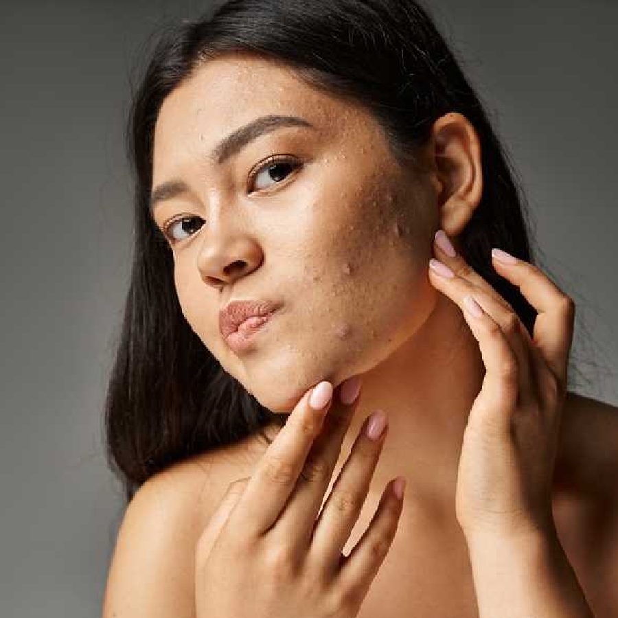 How to use curry leaves for skin problems dgtl