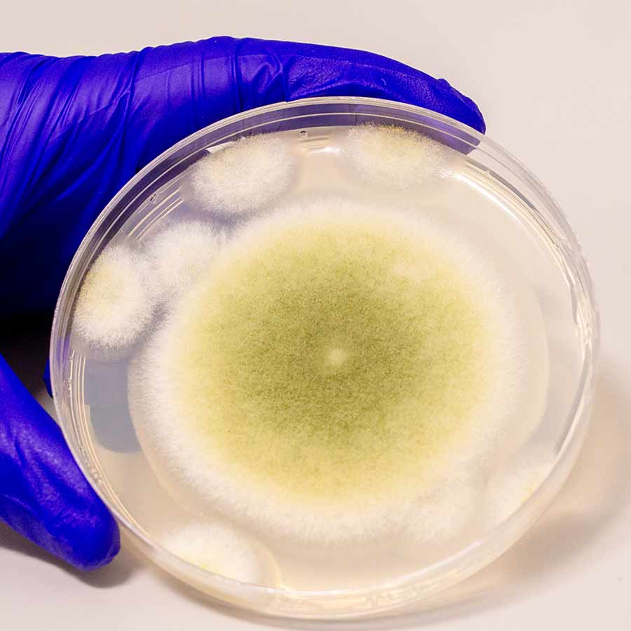 ‘অ্যাসপারগিলাস ফ্ল্যাভাস’ ছত্রাক।