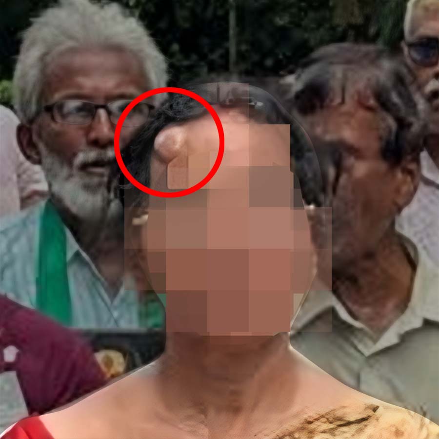 Mother of RG Kar victim discharged from hospital after she injured in Nabanna Abhiyan on saturday dgtl