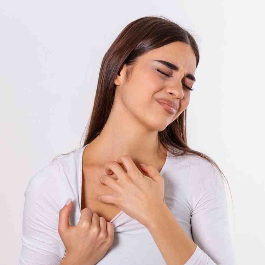 Monsoon season exacerbates fungal acne and rashes due to high humidity
