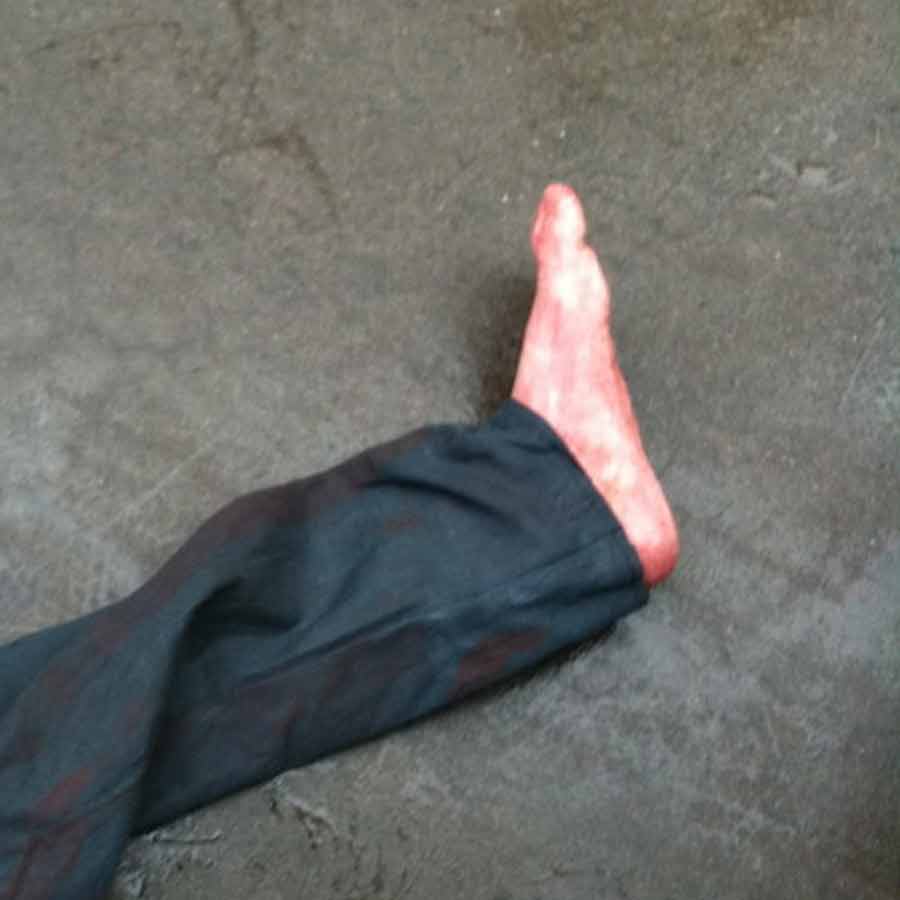 Chopped Leg