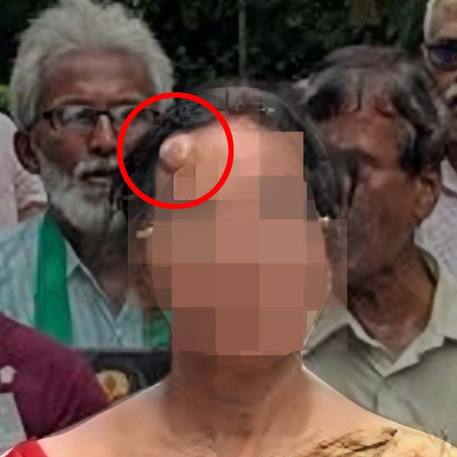 Sources claim Kolkata Police checking video footage of Nabanna Abhijan to get detail about injury linked to mother of RG Kar Victim dgtl