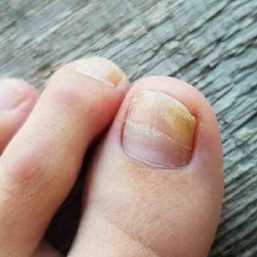 Self-care tips to look after your toenail dgtl