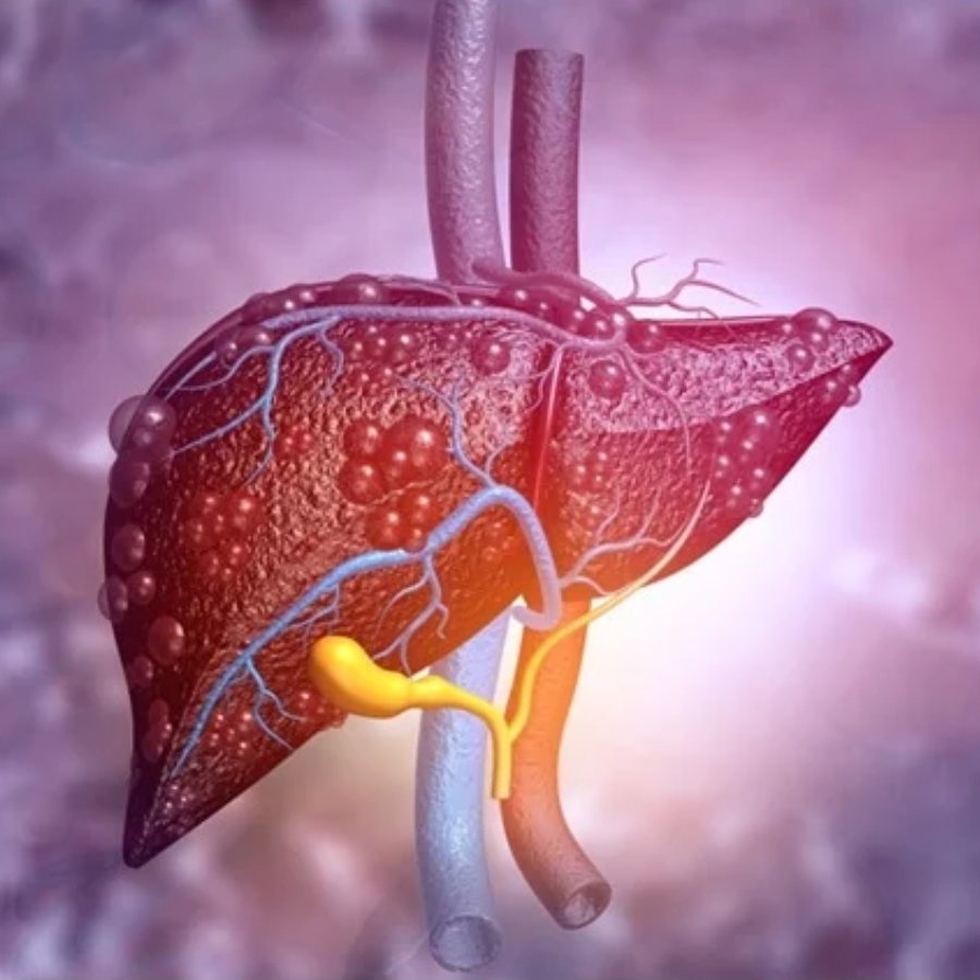 4 skin problems will occur if you are suffering from liver diseases dgtl