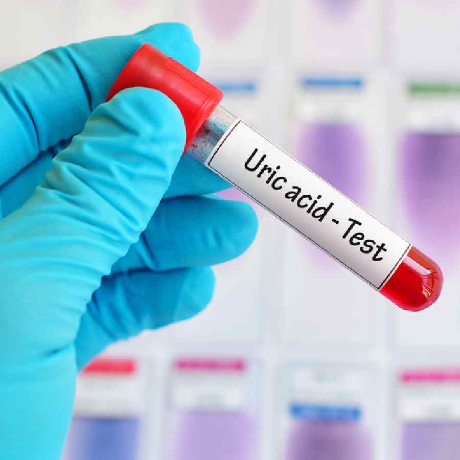 Five vegetables that increase uric acid level in the body dgtl