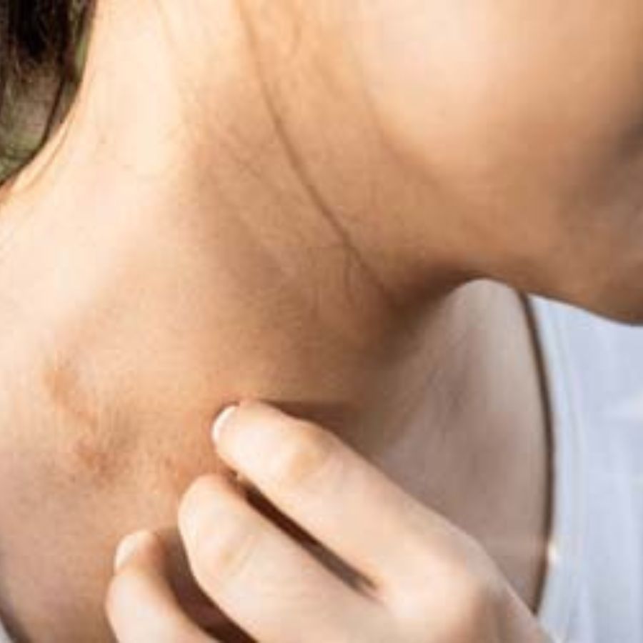 Tips to avoid Black Spots and Skin Itching After Wearing Jewellery dgtl