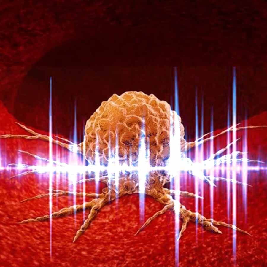 Technique developed at the University of Michigan provides sound waves to destroy tumour