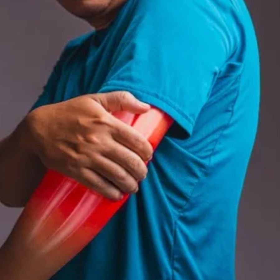 হাতের ব্যথা কি শুধু পেশির টান? হৃদরোগের একটি পরিচিত লক্ষণ হলো, বাঁ হাতের দিকে ছড়িয়ে পড়া ব্যথা। এটি সাধারণত বুক থেকে শুরু হয়ে বাইরের দিকে ছড়িয়ে যায়। আবার এমন মানুষও আছেন, যাঁদের কেবল হাতেই ব্যথা হয়, কিন্তু পরীক্ষা করে দেখা যায় এটি হৃদরোগের লক্ষণ।