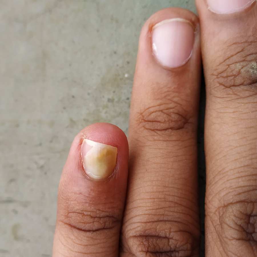 Your nails say a lot about your health, so stop ignoring them dgtl