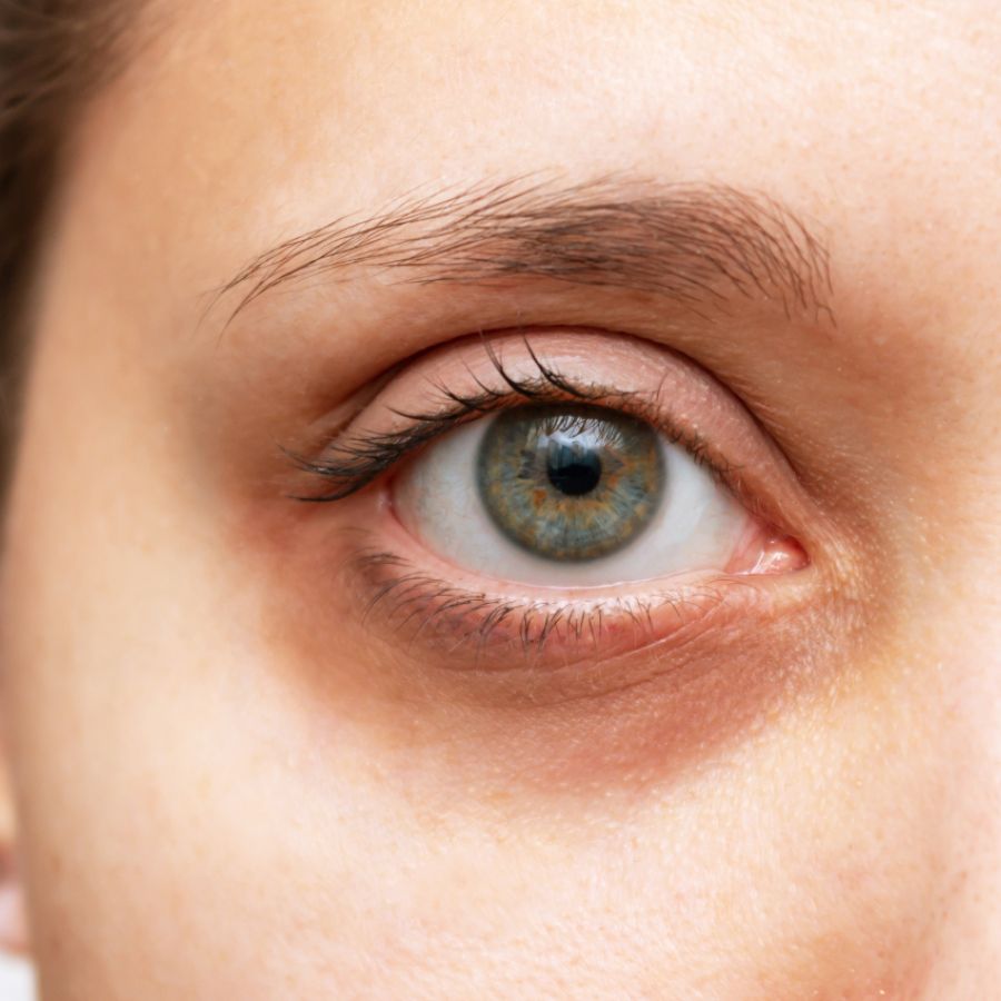 ৭। চোখের নীচের কালি বা হালকা বলিরেখা অনেক সময়ে সাজকে ম্লান করে দেয়। পুজোর কয়েকটা দিন তো আর কোনও ক্লান্তি বা মলিনতা মুখে ধরে রাখা যায় না। 