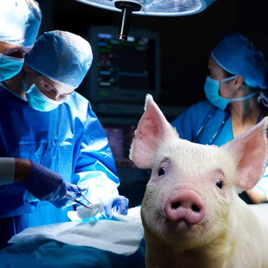 Surgeons in China have performed the first-ever transplant of a gene-edited pig lung into a brain-dead human