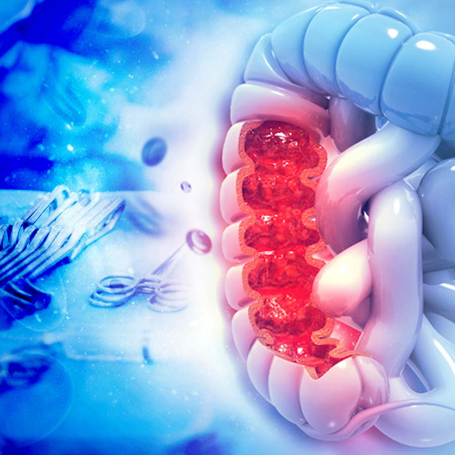 Advanced robotic surgery helped Man to beat colon cancer