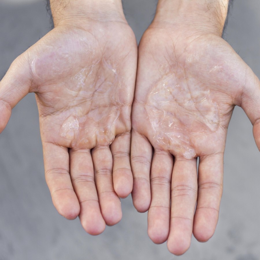 হাতের শুষ্কতা কমাবেন কী ভাবে?